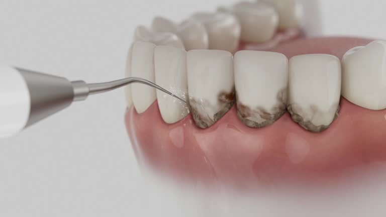 Trusted Emergency Dentist service in Coalgate, OK - Dentist Open Now